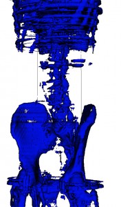 3D scan image of bones